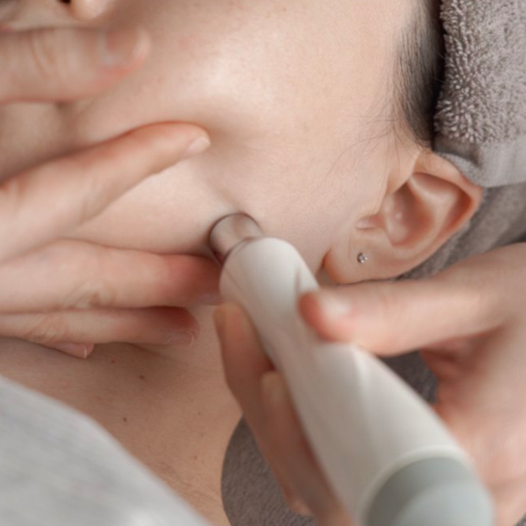 SugarKMicrodermabrasion.png