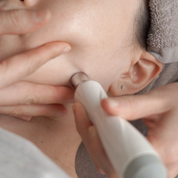 Sugar K Microdermabrasion