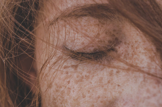 What Causes Your Skin To Darken?